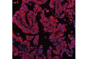 IF analysis of PDK2 using anti-PDK2 antibody (ABIN5693279). (PDK2 anticorps  (AA 81-177))