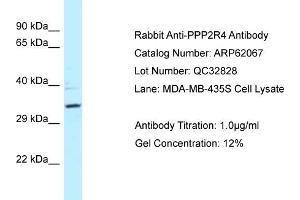 Western Blotting (WB) image for anti-Protein Phosphatase 2A Activator, Regulatory Subunit 4 (PPP2R4) (N-Term) antibody (ABIN2789005) (PPP2R4 anticorps  (N-Term))