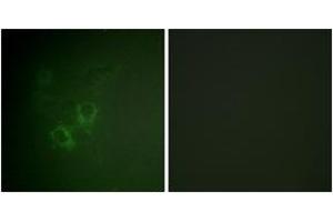Immunofluorescence analysis of HeLa cells, using AhR (Ab-36) Antibody. (Aryl Hydrocarbon Receptor anticorps  (AA 2-51))
