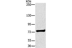 Western blot analysis of K562 cell, using HSD17B4 Polyclonal Antibody at dilution of 1:400 (HSD17B4 anticorps)