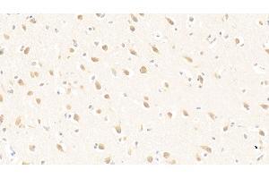 Detection of PURA in Human Cerebrum Tissue using Polyclonal Antibody to Purine Rich Element Binding Protein A (PURA) (PURA anticorps  (AA 1-322))