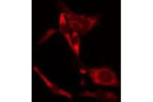 ABIN6275647 staining NIH-3T3 cells by IF/ICC. (PEAK1 anticorps  (Internal Region))
