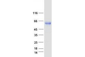 Validation with Western Blot