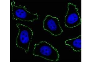Fluorescent image of A549 cell stained with CD33 antibody at 1:25.