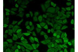 Figure:FITC staining on IHC-P Simple: Hela cells (PGK1 anticorps  (AA 2-417))