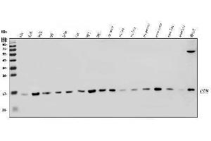 Western blot analysis of LSM8 using anti-LSM8 antibody (ABIN7599579). (NAA38 anticorps  (AA 1-96))