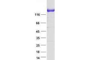 Validation with Western Blot