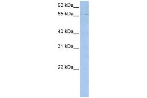 WB Suggested Anti-ABCF3 Antibody Titration:  0. (ABCF3 anticorps  (N-Term))