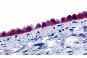 Immunohistochemistry (Formalin/PFA-fixed paraffin-embedded sections) of human ovary, epithelium with GPR133 polyclonal antibody . (G Protein-Coupled Receptor 133 anticorps  (Extracellular Domain))