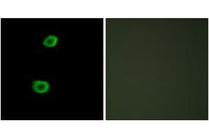 Immunofluorescence analysis of HepG2 cells, using LMTK2 Antibody. (LMTK2 anticorps  (AA 651-700))