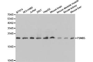 Western blot analysis of extracts of various cell lines, using PSMB5 antibody. (PSMB5 anticorps)