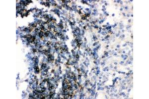 IHC-P: CD79b antibody testing of human tonsil tissue (CD79b anticorps  (AA 29-229))