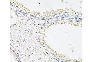 Immunohistochemistry of paraffin-embedded Human prostate using EPOR Polyclonal Antibody at dilution of 1:100 (40x lens). (EPOR anticorps)