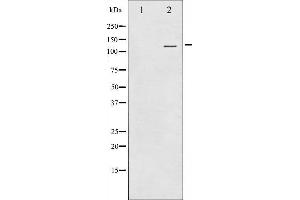 Western blot analysis of RBL2 using MCF7 whole cell lysates (p130 anticorps  (C-Term))