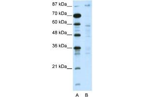 WB Suggested Anti-DMAP1 Antibody Titration:  5. (DMAP1 anticorps  (C-Term))