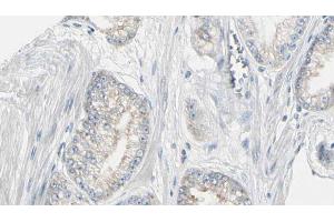 ABIN6272978 at 1/100 staining Human prostate tissue by IHC-P.