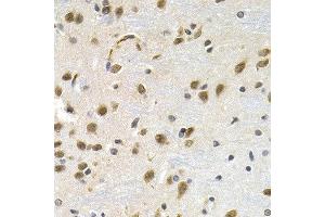 Immunohistochemistry of paraffin-embedded rat brain using LBR antibody at dilution of 1:200 (40x lens). (Lamin B Receptor anticorps)