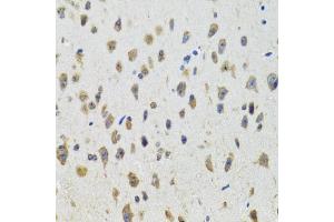 Immunohistochemistry of paraffin-embedded mouse brain using CYP19A1 antibody (ABIN5971188) at dilution of 1/100 (40x lens).