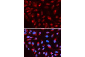 Immunofluorescence analysis of U2OS cell using CTBP1 antibody. (CTBP1 anticorps)