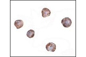 Immunohistochemistry (IHC) image for anti-X-Box Binding Protein 1 (XBP1) (AA 2-160) antibody (ABIN492537)