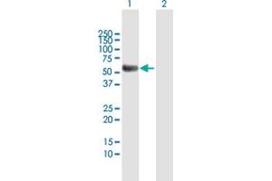 Western Blot analysis of TYR expression in transfected 293T cell line by TYR MaxPab polyclonal antibody.