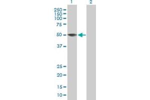 Western Blot analysis of ZCCHC12 expression in transfected 293T cell line by ZCCHC12 MaxPab polyclonal antibody. (ZCCHC12 anticorps  (AA 1-402))
