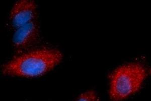 Immunofluorescence (IF) image for anti-Fatty Acid Binding Protein 4, Adipocyte (FABP4) (AA 1-132) antibody (PE) (ABIN5567676) (FABP4 anticorps  (AA 1-132) (PE))
