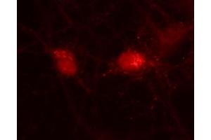 Immunofluorescence labeling of rat hippocampal neurons (dilution 1 : 500). (VTI1A anticorps  (AA 2-185))