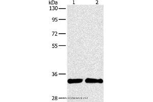 Western blot analysis of A431 and 231 cell, using ARTN Polyclonal Antibody at dilution of 1:350 (ARTN anticorps)