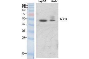 Western Blotting (WB) image for anti-Glucagon-Like Peptide 1 Receptor (GLP1R) (Internal Region) antibody (ABIN3184801)