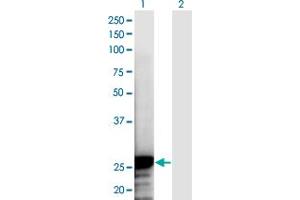 Western Blot analysis of NOL3 expression in transfected 293T cell line by NOL3 monoclonal antibody (M03A), clone 6F5. (NOL3 anticorps  (AA 1-208))
