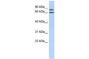 FSIP1 antibody used at 1 ug/ml to detect target protein. (FSIP1 anticorps  (Middle Region))