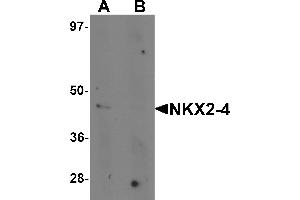 Western blot analysis of NKX2-4 in A20 cell lysate with NKX2-4 antibody at 1 µg/mL in (A) the absence and (B) the presence of blocking peptide.