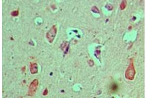 Image no. 1 for anti-Cactin, Spliceosome C Complex Subunit (CACTIN) (AA 460-510) antibody (ABIN960103)