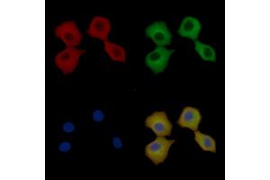 p130 Cas Mouse Monoclonal Antibody staining Hela cells by IF/ICC. (BCAR1 anticorps  (Internal Region))