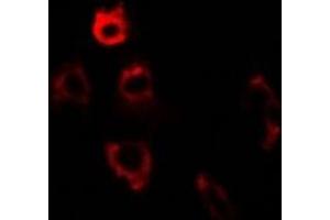 Immunofluorescent analysis of ERp5 staining in U2OS cells. (PDIA6 anticorps)
