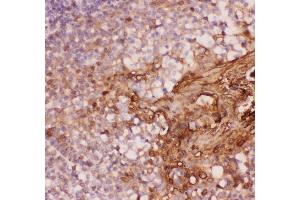 Anti-Annexin A1 Picoband antibody,  IHC(P): Human Tonsil Tissue