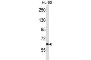 ANKHD1 Antibody (N-term) western blot analysis in HL-60 cell line lysates (35µg/lane).