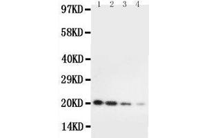 Anti-mouse IL10 antibody, Western blotting Lane 1: Recombinant Mouse IL10 Protein 10ng Lane 2: Recombinant Mouse IL10 Protein 5ng Lane 3: Recombinant Mouse IL10 Protein 2