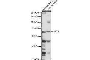 Western blot analysis of extracts of various cell lines, using P antibody (ABIN6130472, ABIN6145188, ABIN6145189 and ABIN6215336) at 1:1000 dilution. (PAK4 anticorps  (AA 120-280))