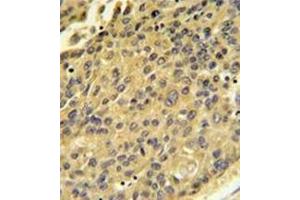Image no. 1 for anti-Cathepsin H (CTSH) (AA 32-62), (N-Term) antibody (ABIN452890)