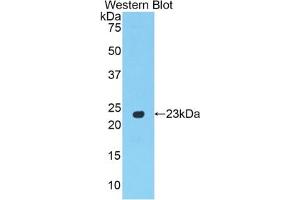 Detection of Recombinant PPARg, Rat using Polyclonal Antibody to Peroxisome Proliferator Activated Receptor Gamma (PPARg)