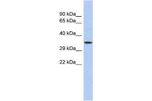 WB Suggested Anti-PRDM12 Antibody Titration: 0. (PRDM12 anticorps  (N-Term))