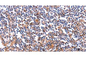 Immunohistochemistry of paraffin-embedded Human tonsil tissue using COL20A1 Polyclonal Antibody at dilution 1:40 (COL20A1 anticorps)