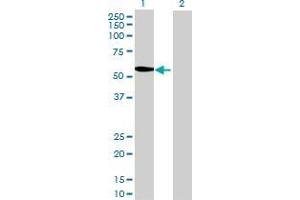 Lane 1: METTL4 transfected lysate ( 52.