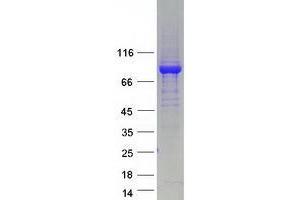 Validation with Western Blot