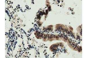 Immunohistochemistry (IHC) image for anti-DnaJ (Hsp40) Homolog, Subfamily A, Member 2 (DNAJA2) antibody (ABIN1497861) (DNAJA2 anticorps)