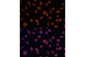 Immunofluorescence analysis of L929 cells using ZCCHC3 antibody (ABIN7271543) at dilution of 1:100. (ZCCHC3 anticorps  (AA 215-335))