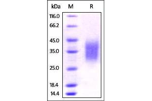 Rat PD-1, His Tag on SDS-PAGE under reducing (R) condition.