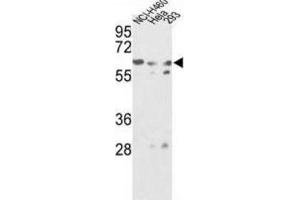Western Blotting (WB) image for anti-Glucosamine (N-Acetyl)-6-Sulfatase (GNS) antibody (ABIN3002692) (GNS anticorps)